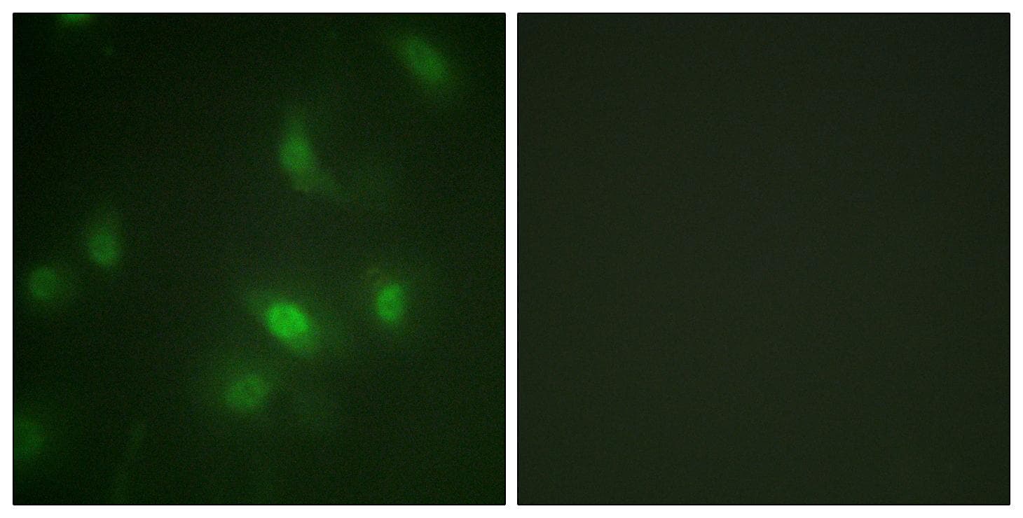 Polyclonal Rabbit anti-Human STAT5A Antibody (phospho-Ser725, IHC, IF, WB)