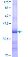 Human RPL21 / Ribosomal Protein L21 (Recombinant GST, N-terminus)