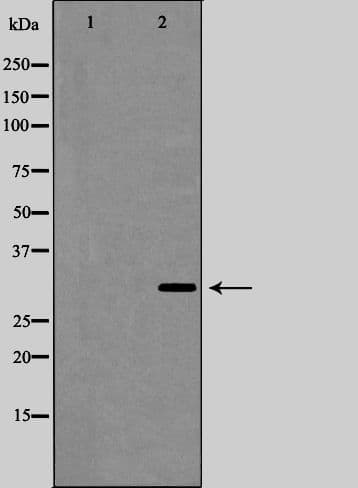 Polyclonal Rabbit anti-Human IL-1B / IL-1 Beta Antibody (IHC, IF, WB)