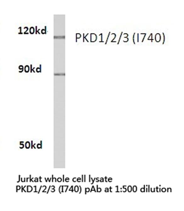 PRKD1 / PKC Mu Antibody (Ile740)