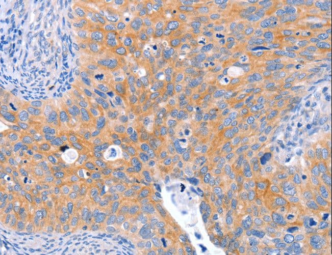 Polyclonal Rabbit anti-Human ABO Glycosyltransferase Antibody (IHC)