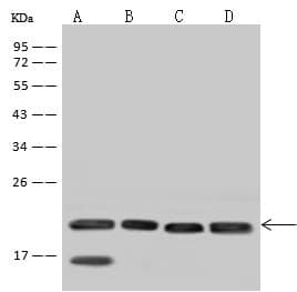 SSR3 / TRAP-Gamma Antibody