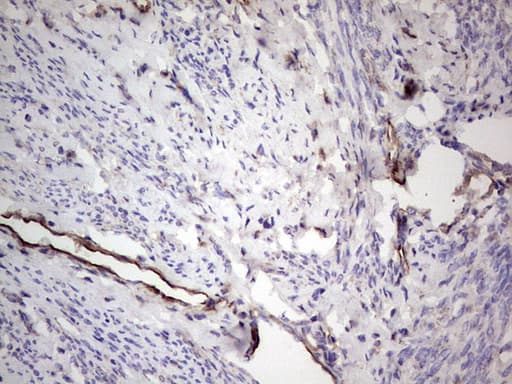 PROCR / EPCR Antibody (aa1-210, clone OTI13E1)