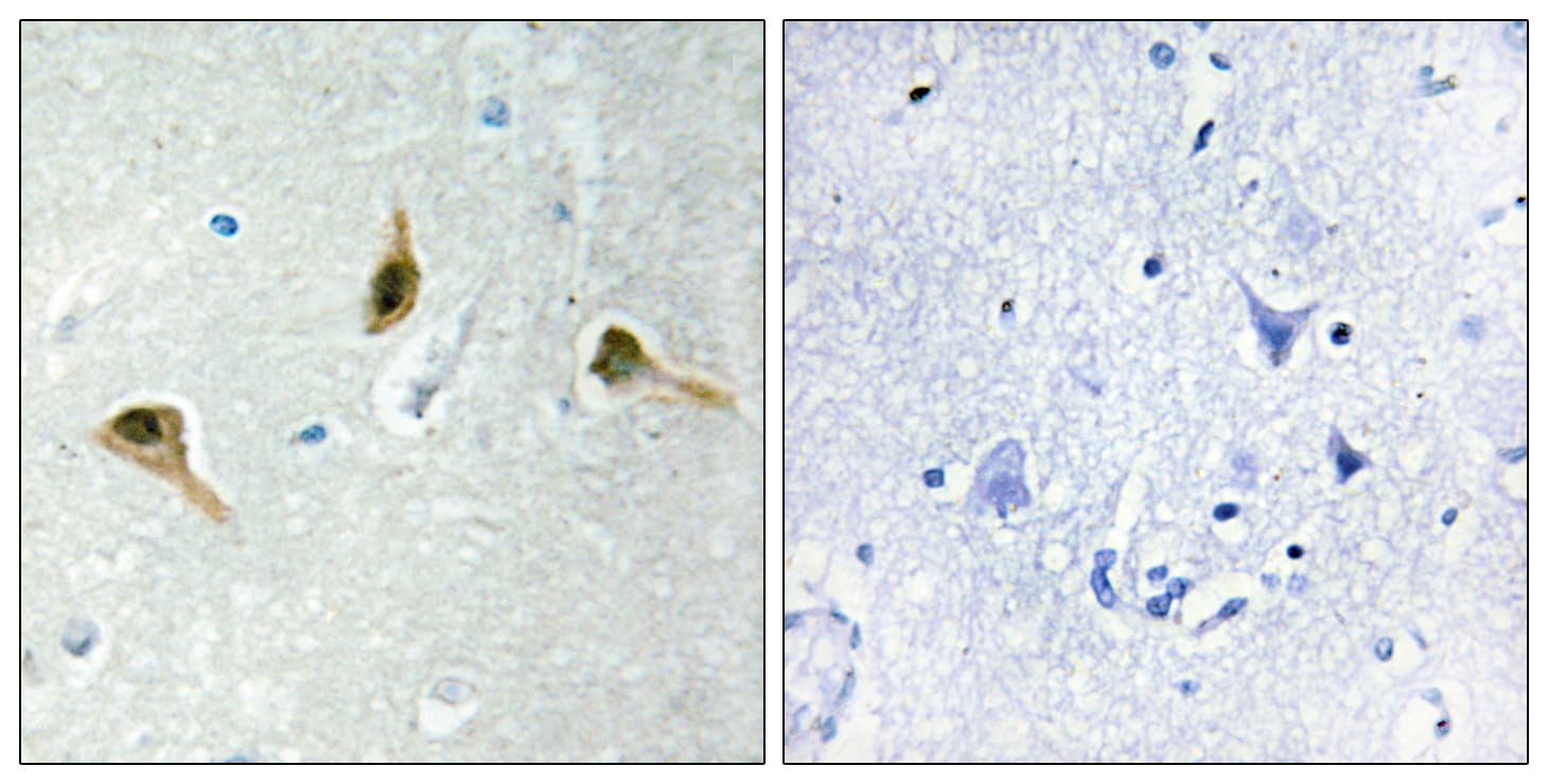 Polyclonal Rabbit anti-Human MSH2 Antibody (aa541-590, IHC, IF)