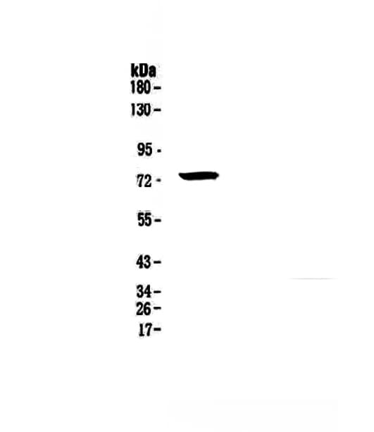 IRAK1 / IRAK Antibody