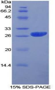 Human PRNP / PrP / Prion Protein (Recombinant His, N-Terminal)