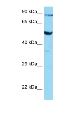 SLC2A3 / GLUT3 Antibody (aa181-230)