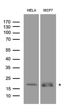 RMI2 / C16orf75 Antibody