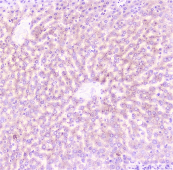 Polyclonal Rabbit anti-Human CRP / C-Reactive Protein Antibody (IHC, WB)