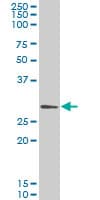 GCLM Antibody (clone 2B8)