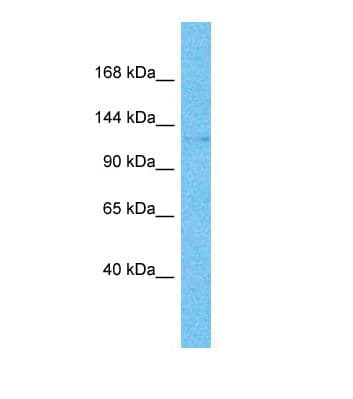 TERT / Telomerase Antibody (C-Terminus)