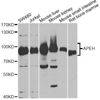 Polyclonal Rabbit anti-Human APH / APEH Antibody (IF, WB)