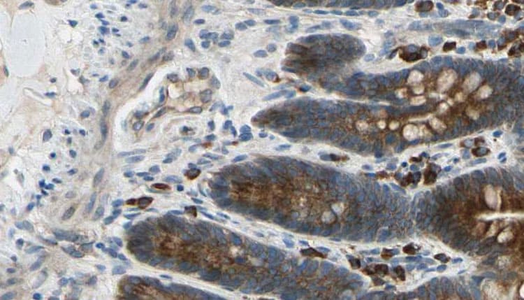 CAMKV Antibody