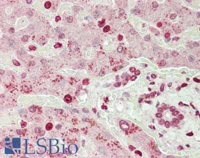 IHC-plus™ Polyclonal Rabbit anti-Human WWOX Antibody (N-Terminus, IHC, WB)