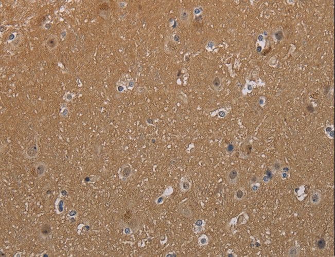 Polyclonal Rabbit anti-Human MAGEL2 Antibody (aa731-744, IHC)