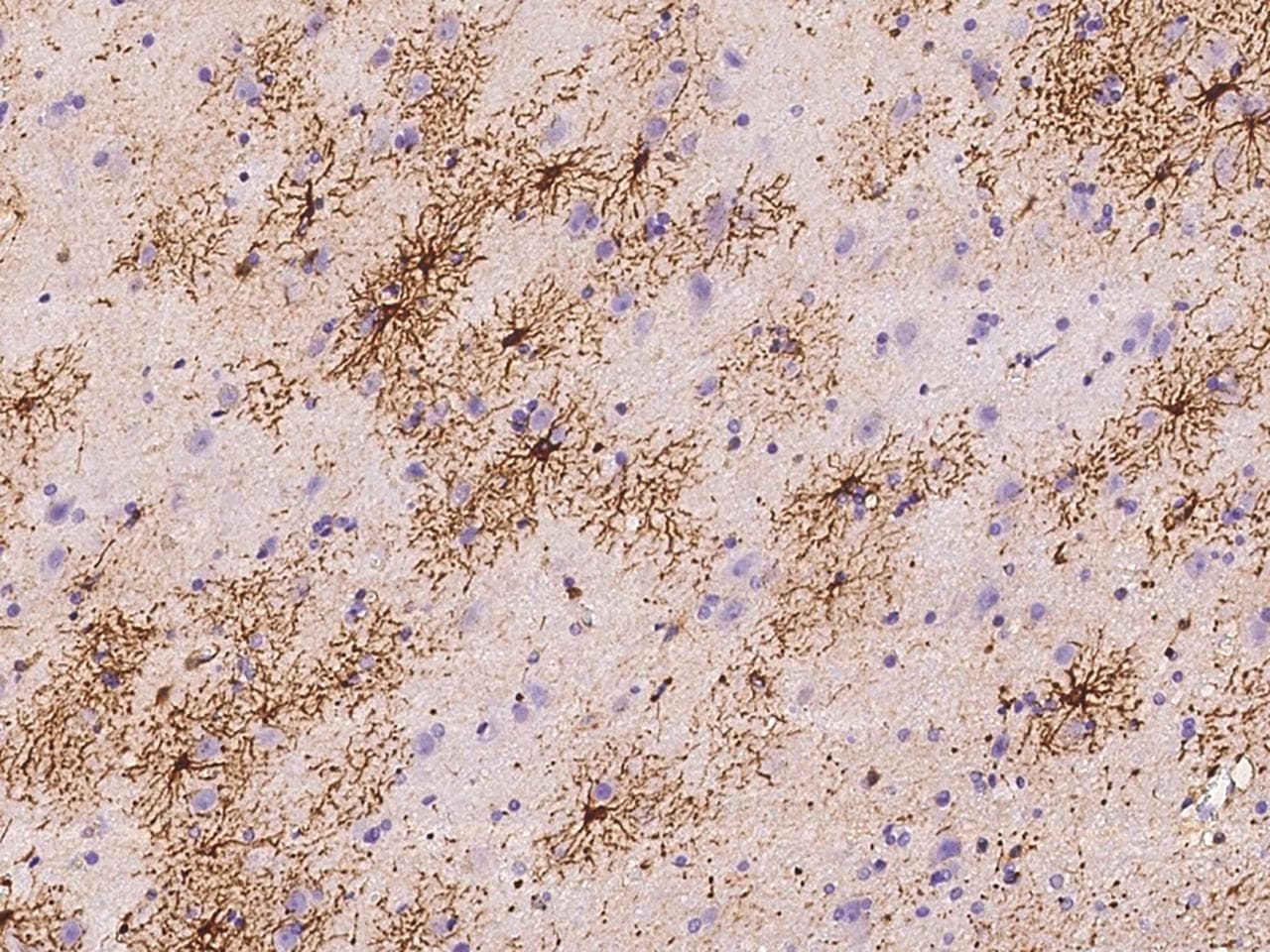 Polyclonal Rabbit anti-Human UGT3A1 Antibody (IHC)