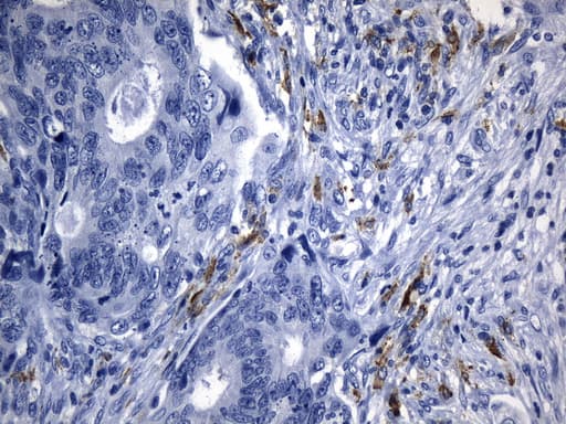 Monoclonal Mouse anti-Human MSR1 / CD204 Antibody (clone UMAB246, Carrier-free, aa197-451, IHC)