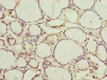 CEP44 / KIAA1712 Antibody