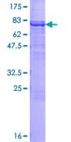Human CARD14 Protein (Recombinant GST)