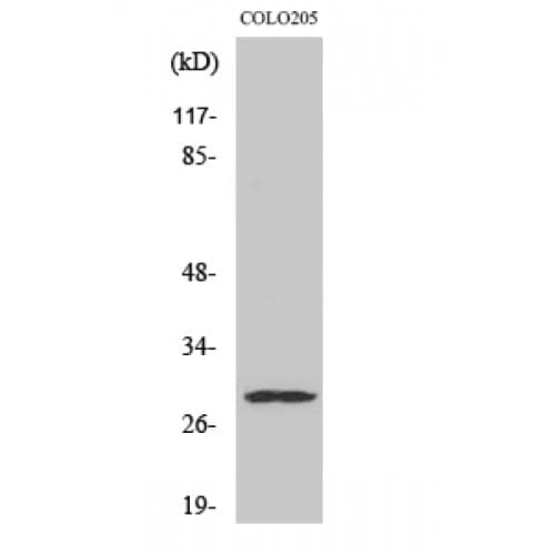 Polyclonal Rabbit anti-Human PEX11B Antibody (60-140 aa, Internal, WB)