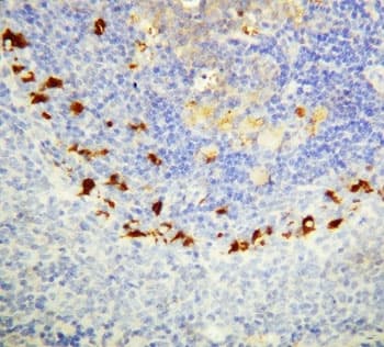Polyclonal Rabbit anti-Human SOCS1 Antibody (aa197-211, IHC, WB)