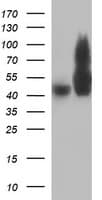 TUBB2B / Tubulin Beta 2B Antibody (clone OTI2G4, Carrier-free)