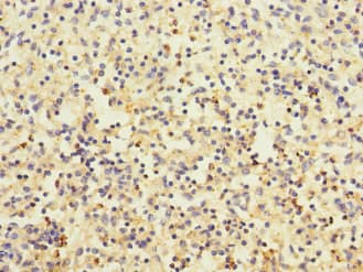 DEC-205 / CD205 / LY75 Antibody