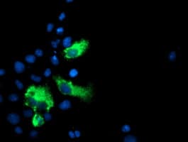 MAC-2-BP / LGALS3BP Antibody (clone OTI3G8)