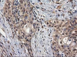DSTN / Destrin Antibody (clone OTI2C10)