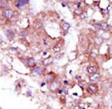 STK33 Antibody (aa476-506)