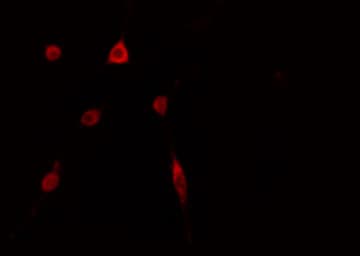 Polyclonal Rabbit anti-Human TOP3B Antibody (IF, WB)