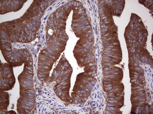 GARS / Glycyl tRNA Synthetase Antibody (clone OTI6C5)