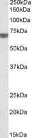 IHC-plus™ TGFBI Antibody (aa119-131)