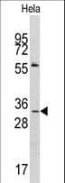 MAGEA1 / MAGE 1 Antibody (aa143-173)