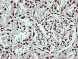 THUMPD1 Antibody (clone OTI1H6)