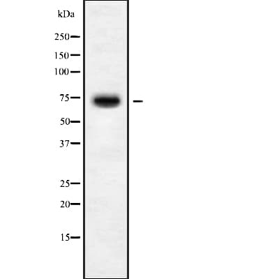Polyclonal Rabbit anti-Human KLHL36 Antibody (WB)