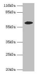 EPHX2 / Epoxide Hydrolase 2 Antibody (aa1-555)