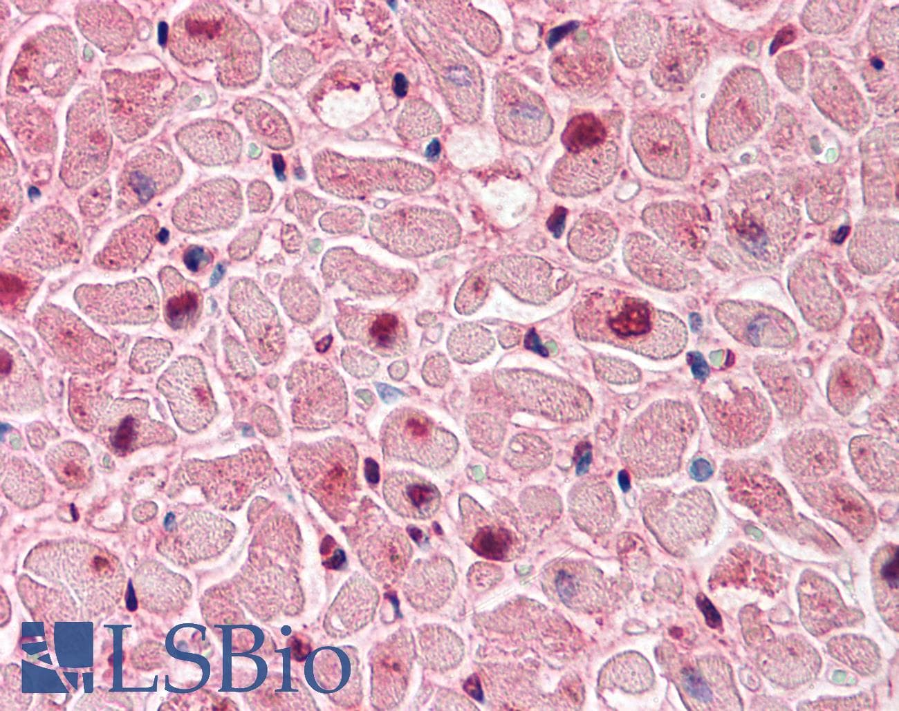 IHC-plus™ Polyclonal Rabbit anti-Human QSOX2 Antibody (Internal, IHC)