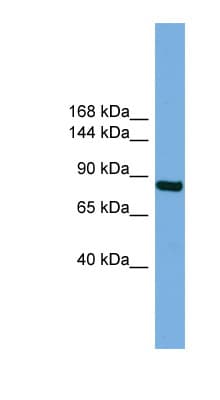 Polyclonal Rabbit anti-Human RSBN1 Antibody (aa35-84, WB)