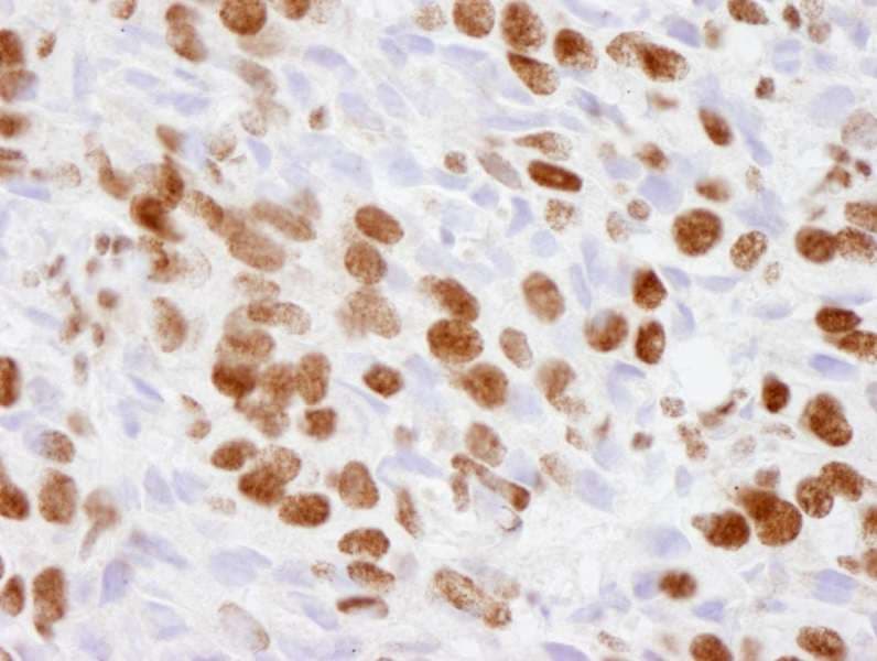 EP300 / p300 Antibody (aa950-1000)
