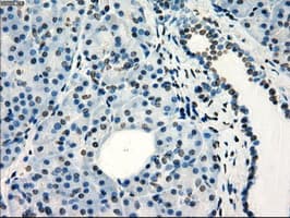 Monoclonal Mouse anti-Human FRK Antibody (clone OTI6D2, IHC, IF, WB)