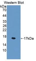 Human IL4 Protein (Recombinant His, N-Terminal)