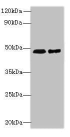 Polyclonal Rabbit anti-Human AARSD1 Antibody (IHC, WB)