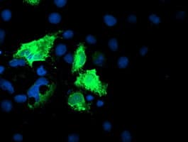 IDS / Iduronate 2 Sulfatase Antibody (clone OTI1D9)