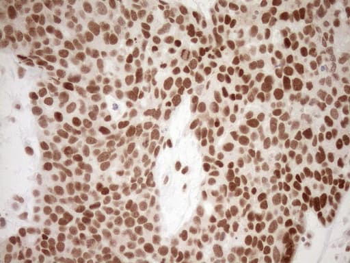NR1H3 / LXR Alpha Antibody (aa69-329, clone OTI1A5)
