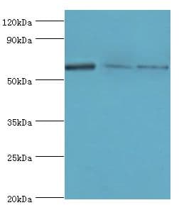 PRKAA2 / AMPK Alpha 2 Antibody (aa343-552)