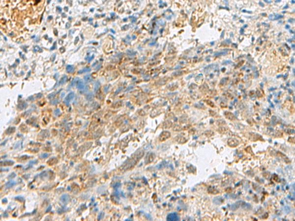 PRPF3 Antibody