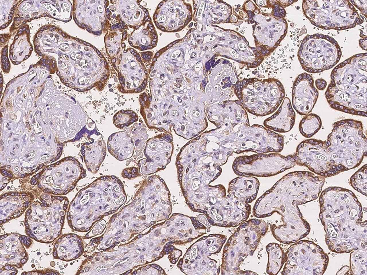 CD119 / IFNGR1 Antibody