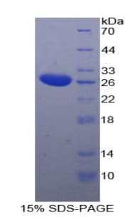Human TPPP Protein (Recombinant His-T7)
