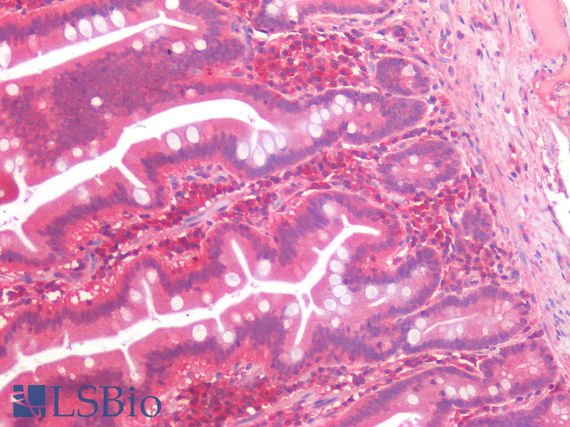 IHC-plus™ CX3CL1 / Fractalkine Antibody